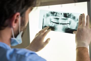 Dentist looking at dental x ray
